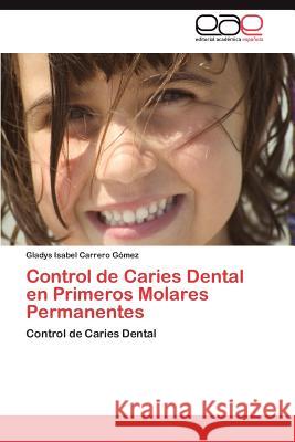 Control de Caries Dental en Primeros Molares Permanentes Carrero Gómez Gladys Isabel 9783846574836 Editorial Acad Mica Espa Ola - książka