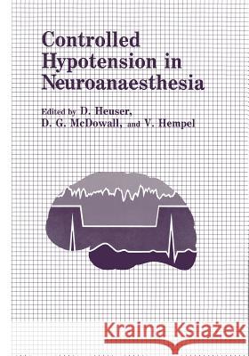 Controlled Hypotension in Neuroanaesthesia D. Heuser 9781461295129 Springer - książka