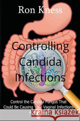 Controlling Candida Infections: Control the Candida Fungus That Could Be Causing Your Vaginal Infections And Others Kness, Ron 9781545448922 Createspace Independent Publishing Platform - książka