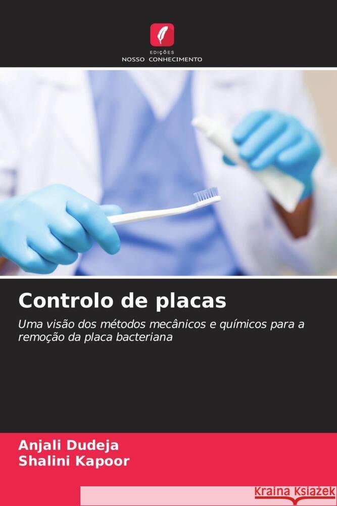 Controlo de placas Dudeja, Anjali, Kapoor, Shalini 9786205483886 Edições Nosso Conhecimento - książka