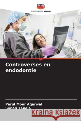 Controverses en endodontie Parul Mour Agarwal Sonali Taneja 9786207788354 Editions Notre Savoir - książka