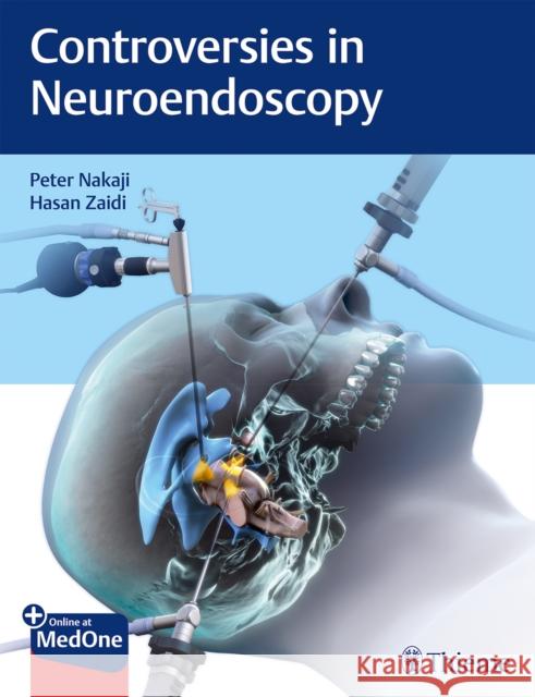 Controversies in Neuroendoscopy Peter Nakaji Hasan A. Zaidi 9781626233539 Thieme Medical Publishers - książka