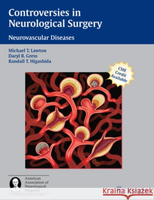Controversies in Neurological Surgery: Neurovascular Diseases Lawton, Michael T. 9781588903440 Thieme Medical Publishers - książka