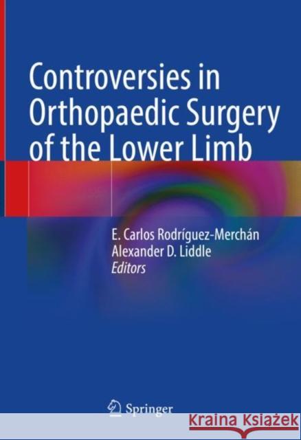 Controversies in Orthopaedic Surgery of the Lower Limb Rodr Alexander D. Liddle 9783030806941 Springer - książka