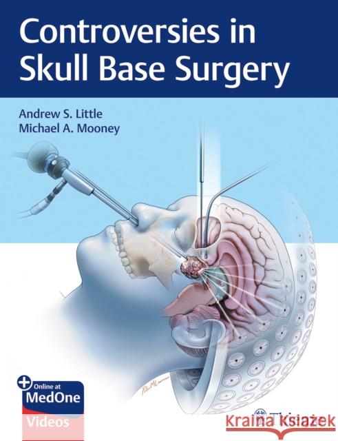 Controversies in Skull Base Surgery Little, Andrew S. 9781626239531 Thieme Medical Publishers - książka