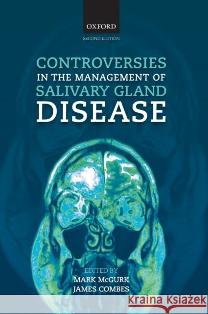 Controversies in the Management of Salivary Gland Disease Mark McGurk Luke Cascarini 9780199578207 Oxford University Press, USA - książka