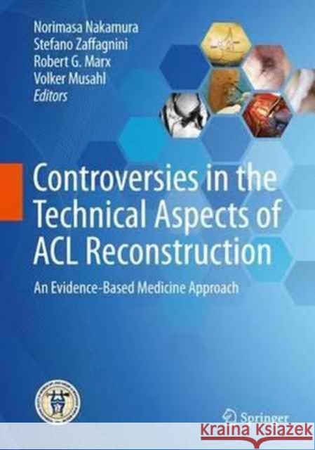 Controversies in the Technical Aspects of ACL Reconstruction: An Evidence-Based Medicine Approach Nakamura, Norimasa 9783662527405 Springer - książka