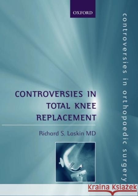 Controversies in Total Knee Replacement Richard S. Laskin 9780192630728 Oxford University Press - książka