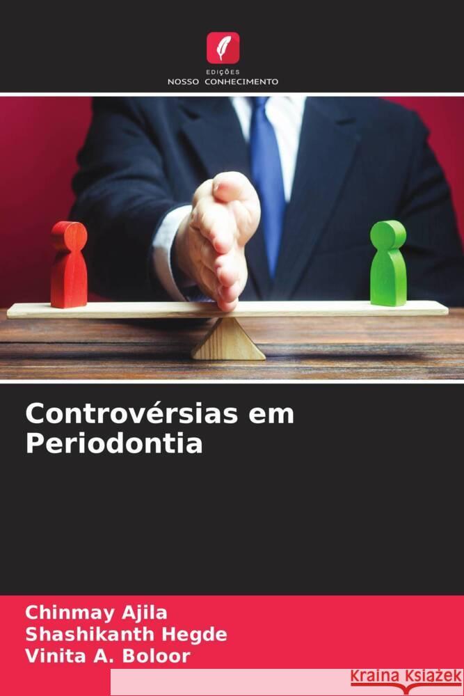 Controv?rsias em Periodontia Chinmay Ajila Shashikanth Hegde Vinita A. Boloor 9786207346219 Edicoes Nosso Conhecimento - książka