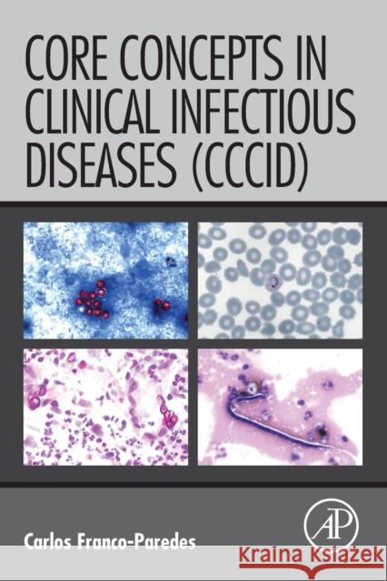 Core Concepts in Clinical Infectious Diseases (CCCID) Carlos Franco-Paredes 9780128044230 ACADEMIC PRESS - książka