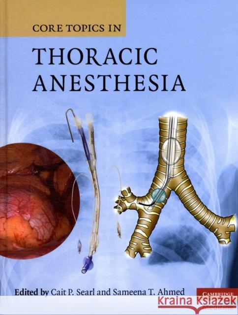 Core Topics in Thoracic Anesthesia Cait P Searl 9780521867122  - książka