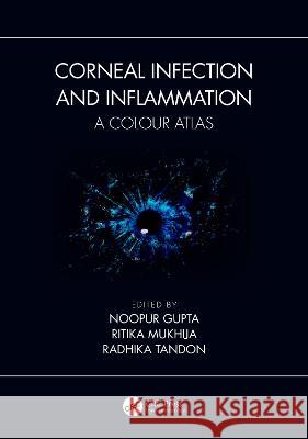Corneal Infection and Inflammation: A Colour Atlas Noopur Gupta Ritika Mukhija Radhika Tandon 9780367457129 CRC Press - książka