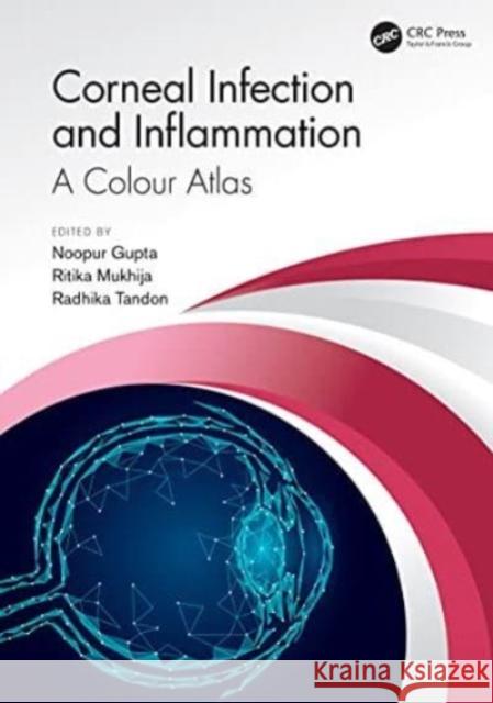 Corneal Infection and Inflammation: A Colour Atlas Noopur Gupta Ritika Mukhija Radhika Tandon 9780367761561 CRC Press - książka