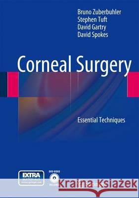 Corneal Surgery: Essential Techniques Zuberbuhler, Bruno 9783642125010 Springer - książka