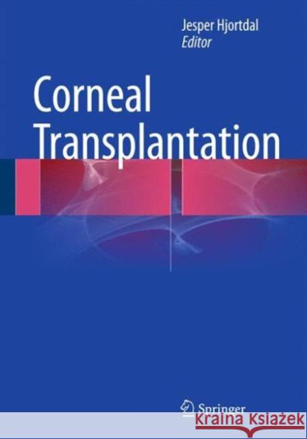 Corneal Transplantation Jesper Hjortdal 9783319240503 Springer - książka