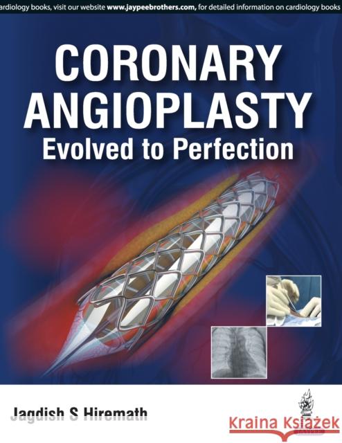 Coronary Angioplasty Evolved To Perfection Hiremath, Jagdish S. 9789386261960 Jaypee Brothers, Medical Publishers Pvt. Ltd. - książka