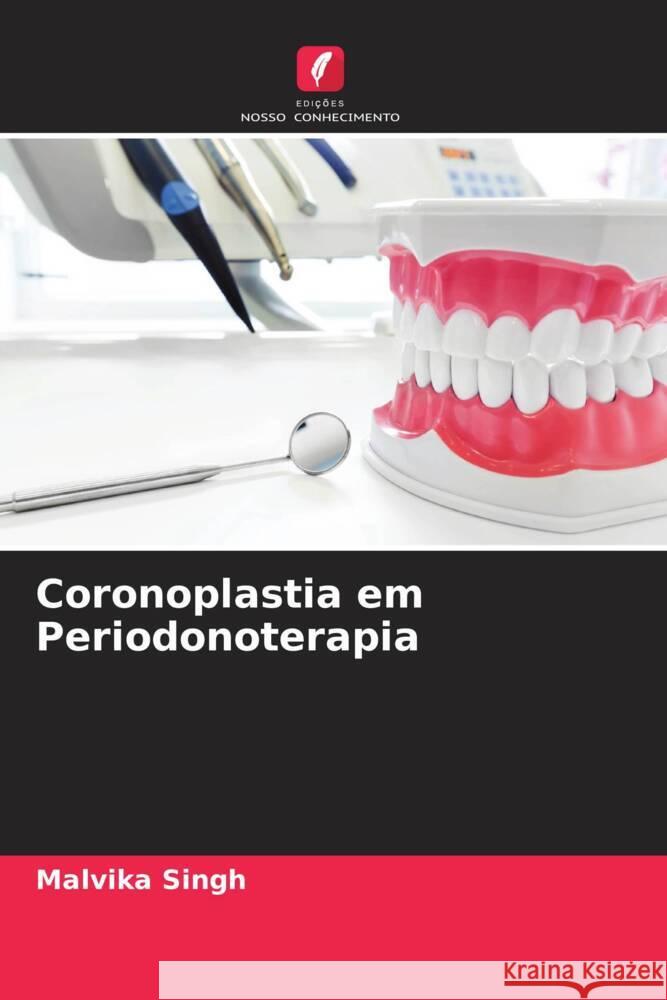 Coronoplastia em Periodonoterapia Singh, Malvika 9786204764054 Edições Nosso Conhecimento - książka