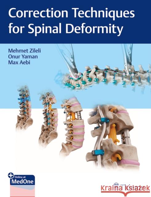 Correction Techniques for Spinal Deformity Mehmet Zileli Onur Yaman Max Aebi 9789395390101 Thieme Medical Publishers - książka