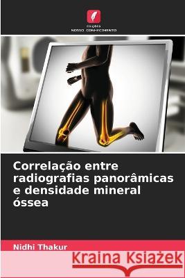 Correla??o entre radiografias panor?micas e densidade mineral ?ssea Nidhi Thakur 9786205835043 Edicoes Nosso Conhecimento - książka