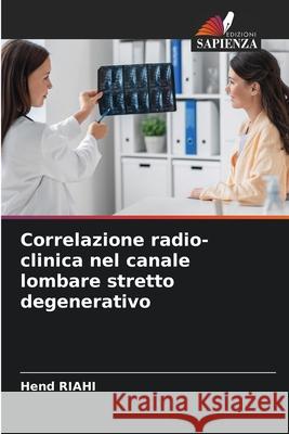 Correlazione radio-clinica nel canale lombare stretto degenerativo Hend Riahi 9786207614837 Edizioni Sapienza - książka