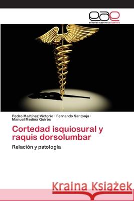 Cortedad isquiosural y raquis dorsolumbar Martínez Victorio, Pedro 9783659067143 Editorial Academica Espanola - książka