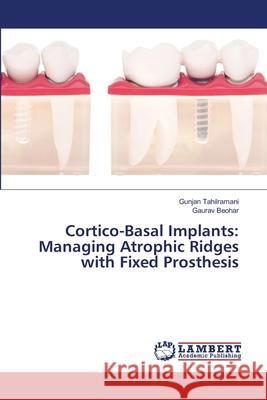Cortico-Basal Implants: Managing Atrophic Ridges with Fixed Prosthesis Gunjan Tahilramani Gaurav Beohar 9786203580983 LAP Lambert Academic Publishing - książka