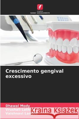 Crescimento gengival excessivo Mody, Dhawal, Lathiya, Vrushali, LANGDE, VAISHNAVI 9786208739560 Edições Nosso Conhecimento - książka