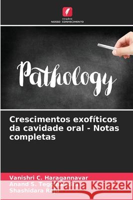 Crescimentos exof?ticos da cavidade oral - Notas completas Vanishri C. Haragannavar Anand S. Tegginamani Shashidara Raju 9786207901340 Edicoes Nosso Conhecimento - książka