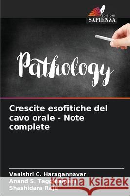 Crescite esofitiche del cavo orale - Note complete Vanishri C. Haragannavar Anand S. Tegginamani Shashidara Raju 9786207901333 Edizioni Sapienza - książka