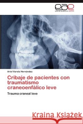 Cribaje de pacientes con traumatismo craneoenfálico leve Varela Hernández Ariel 9783847350811 Editorial Acad Mica Espa Ola - książka