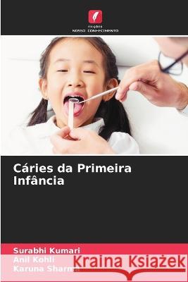 Cáries da Primeira Infância Kumari, Surabhi 9786205308028 Edicoes Nosso Conhecimento - książka