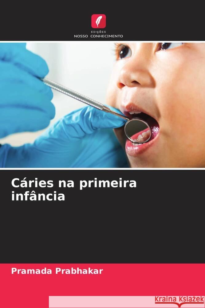 C?ries na primeira inf?ncia Pramada Prabhakar 9786206621133 Edicoes Nosso Conhecimento - książka