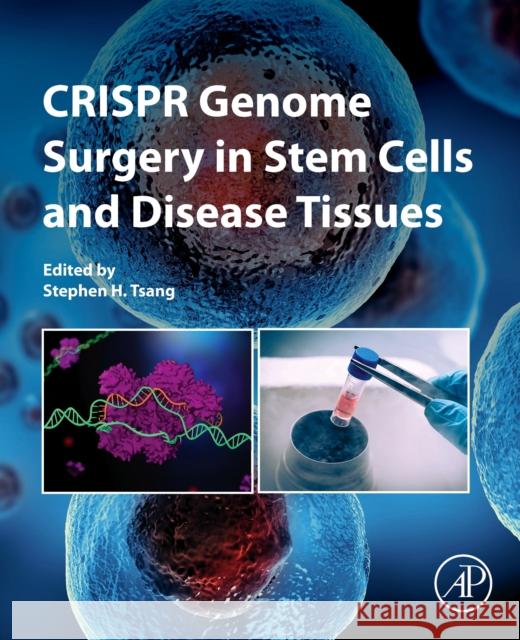 Crispr Genome Surgery in Stem Cells and Disease Tissues Stephen H. Tsang 9780128178768 Academic Press - książka