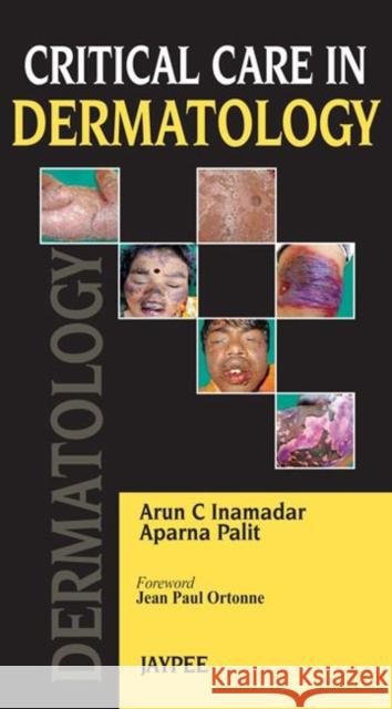 Critical Care in Dermatology Arun C. Inamadar 9789350902851 Jp Medical Ltd - książka
