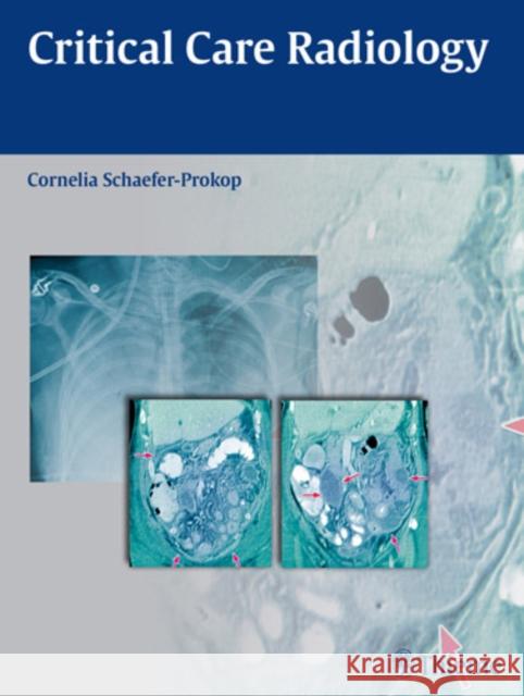 Critical Care Radiology Schaefer-Prokop, Cornelia 9783131500519  - książka