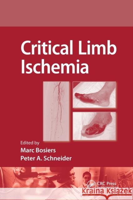 Critical Limb Ischemia Marc Bosiers Peter Schneider 9780367385514 CRC Press - książka