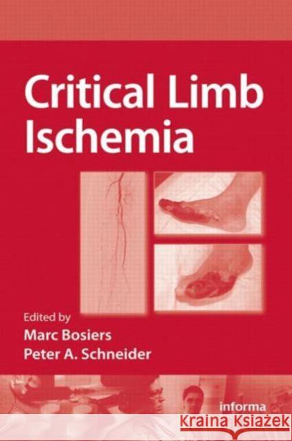 Critical Limb Ischemia Peter Schneider Marc Bosiers 9781420081893 Informa Healthcare - książka