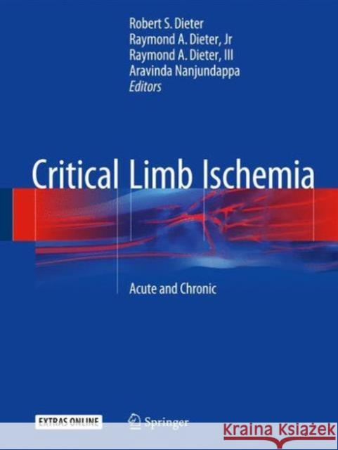 Critical Limb Ischemia: Acute and Chronic Dieter, Robert S. 9783319319896 Springer - książka