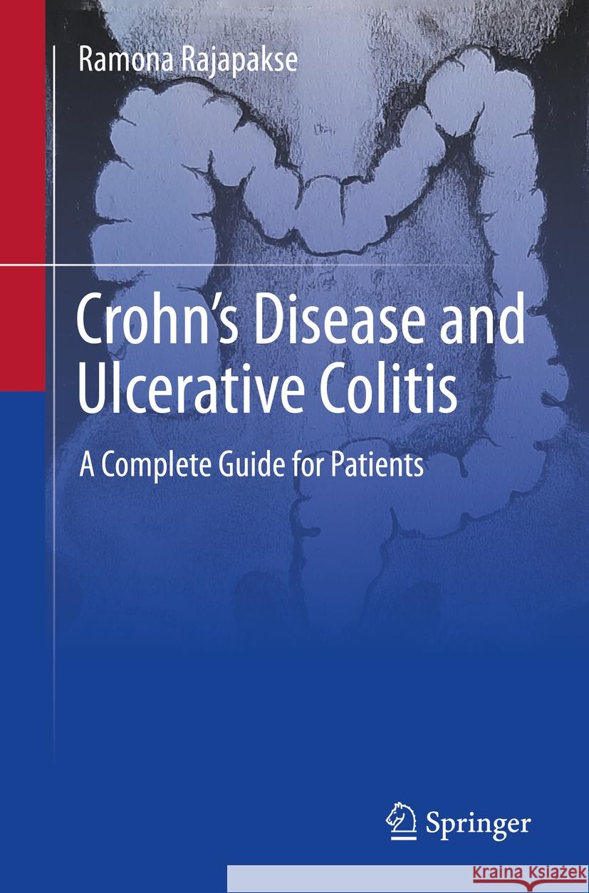 Crohn's Disease and Ulcerative Colitis: A Complete Guide for Patients Ramona Rajapakse 9783031454066 Springer - książka