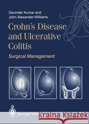 Crohn's Disease and Ulcerative Colitis: Surgical Management Kumar, Devinder 9781447132981 Springer - książka