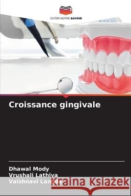 Croissance gingivale Mody, Dhawal, Lathiya, Vrushali, LANGDE, VAISHNAVI 9786208739546 Editions Notre Savoir - książka