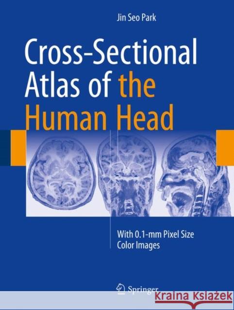 Cross-Sectional Atlas of the Human Head: With 0.1-MM Pixel Size Color Images Park, Jin Seo 9789811007699 Springer - książka