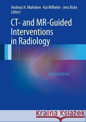 Ct- And Mr-Guided Interventions in Radiology Mahnken, Andreas H. 9783642335808 Springer, Berlin - książka