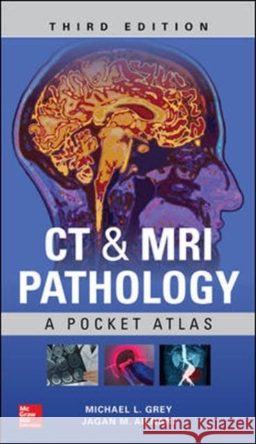 CT & MRI Pathology: A Pocket Atlas, Third Edition Michael L. Grey Jagan Mohan Ailinani 9781260121940 McGraw-Hill Education / Medical - książka