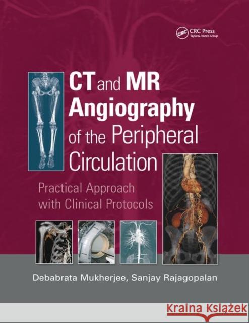 CT and MR Angiography of the Peripheral Circulation: Practical Approach with Clinical Protocols Debabrata Mukherjee Sanjay Rajagopalan 9780367389062 CRC Press - książka