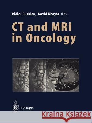 CT and MRI in Oncology Didier Buthiau David Khayat S. Buthiau 9783642468445 Springer - książka