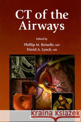 CT of the Airways David Lynch 9781588298485 Humana Press - książka