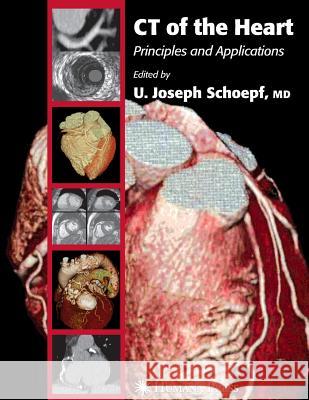 CT of the Heart: Principles and Applications Schoepf, U. Joseph 9781617374814 Springer - książka