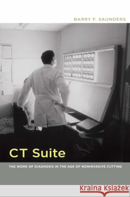 CT Suite: The Work of Diagnosis in the Age of Noninvasive Cutting Saunders, Barry F. 9780822341239 Not Avail - książka