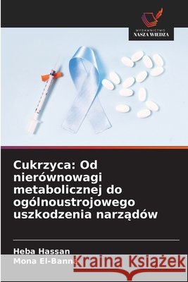Cukrzyca: Od nierównowagi metabolicznej do ogólnoustrojowego uszkodzenia narzadów Hassan, Heba, El-Banna, Mona 9786209640452 Wydawnictwo Nasza Wiedza - książka